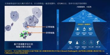 ABCD模型 推动AI技术跨越鸿沟，让AI像水电一样随手可及的物联网技术新范式